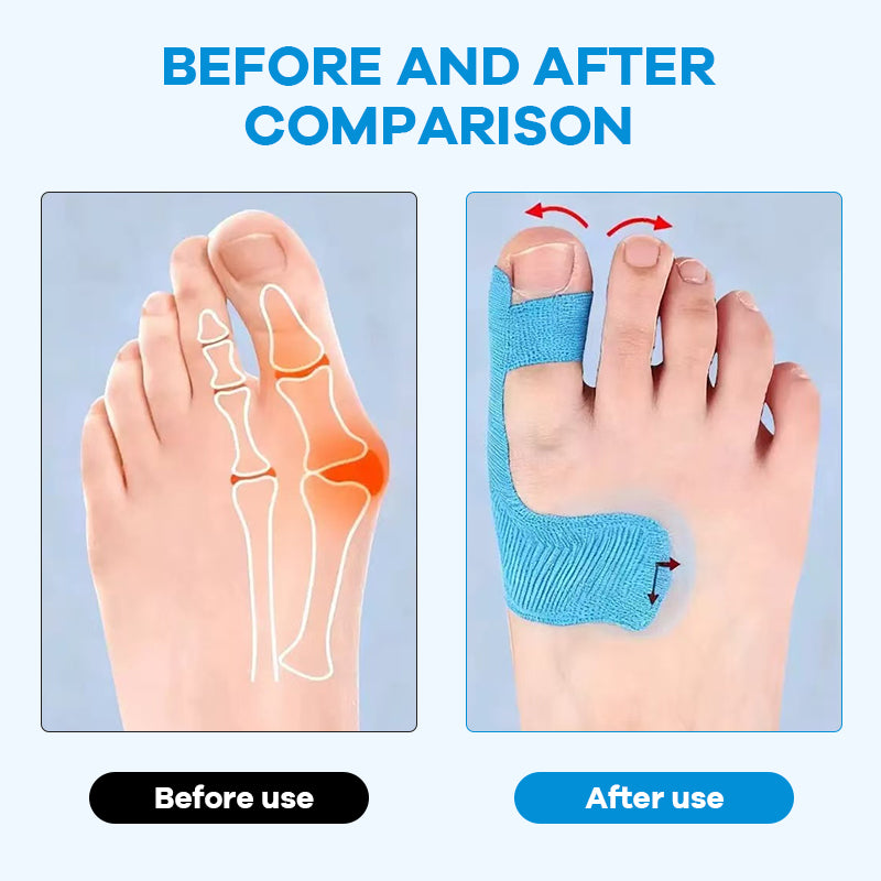 Ferdigskåret kinesiologitape for hallux valgus