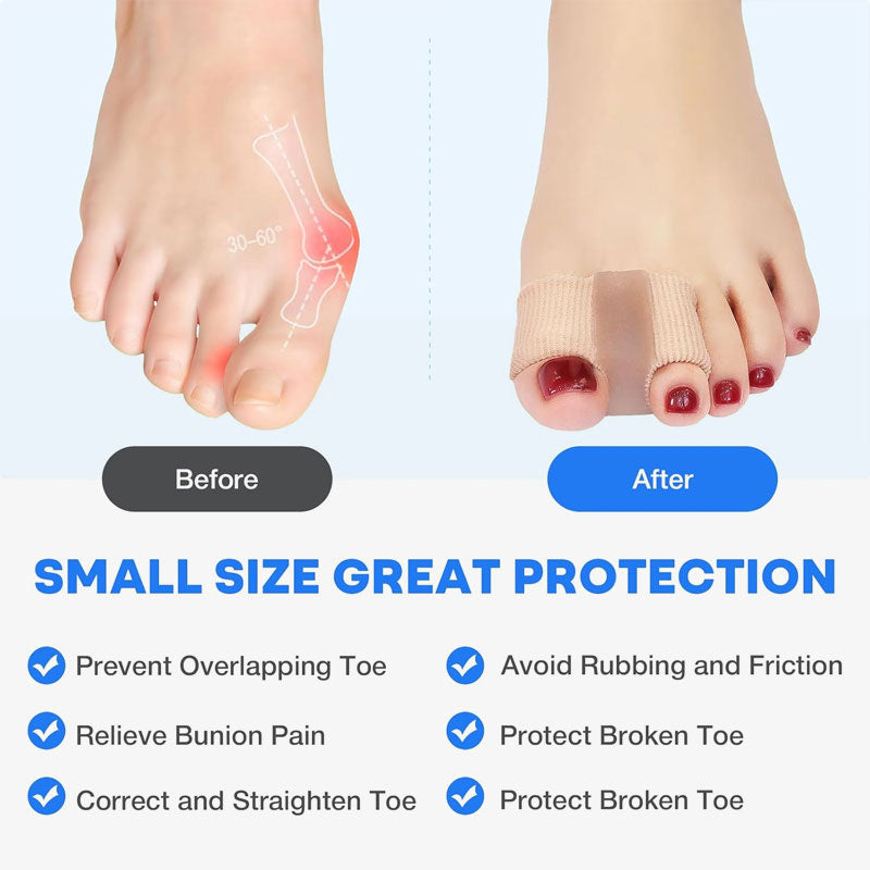 Tåseparator og hallux valguskorrigerer 🦶